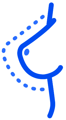 تكبير البريست
